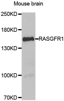 RASGRF1 / CDC25 Antibody