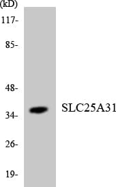 SLC25A31 Antibody (aa118-167)