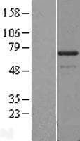 PDLIM5 / LIM Protein (Over-Expression Lysate Myc-DDK (Flag))