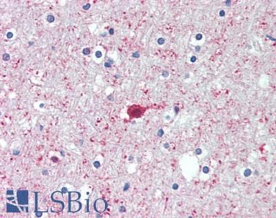 IHC-plus™ PGM2L1 Antibody