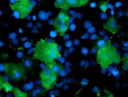 LIMK1 / LIMK Antibody (clone OTI2A11)