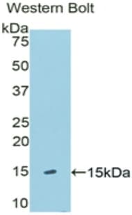 KLB / Beta Klotho Antibody (aa517-636)