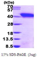 Human SNUPN Protein (Recombinant His)