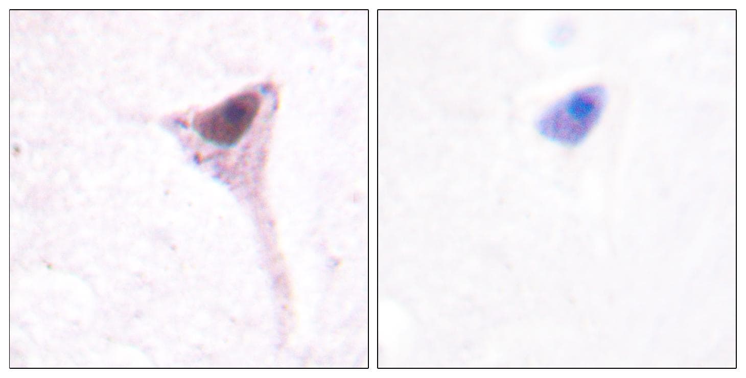 Polyclonal Rabbit anti-Human CCND1 / Cyclin D1 Antibody (p286, IHC, WB)