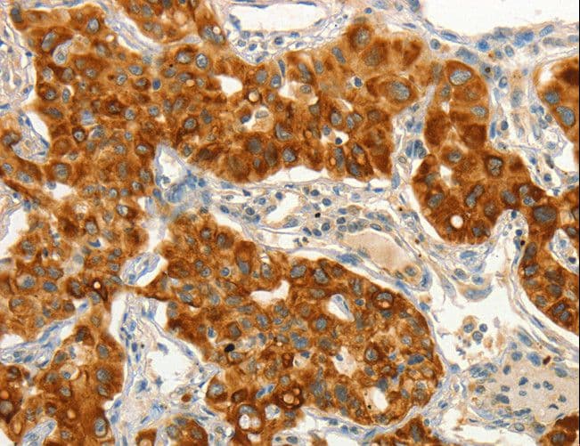 Polyclonal Rabbit anti-Human CIB1 / KIP Antibody (IHC)
