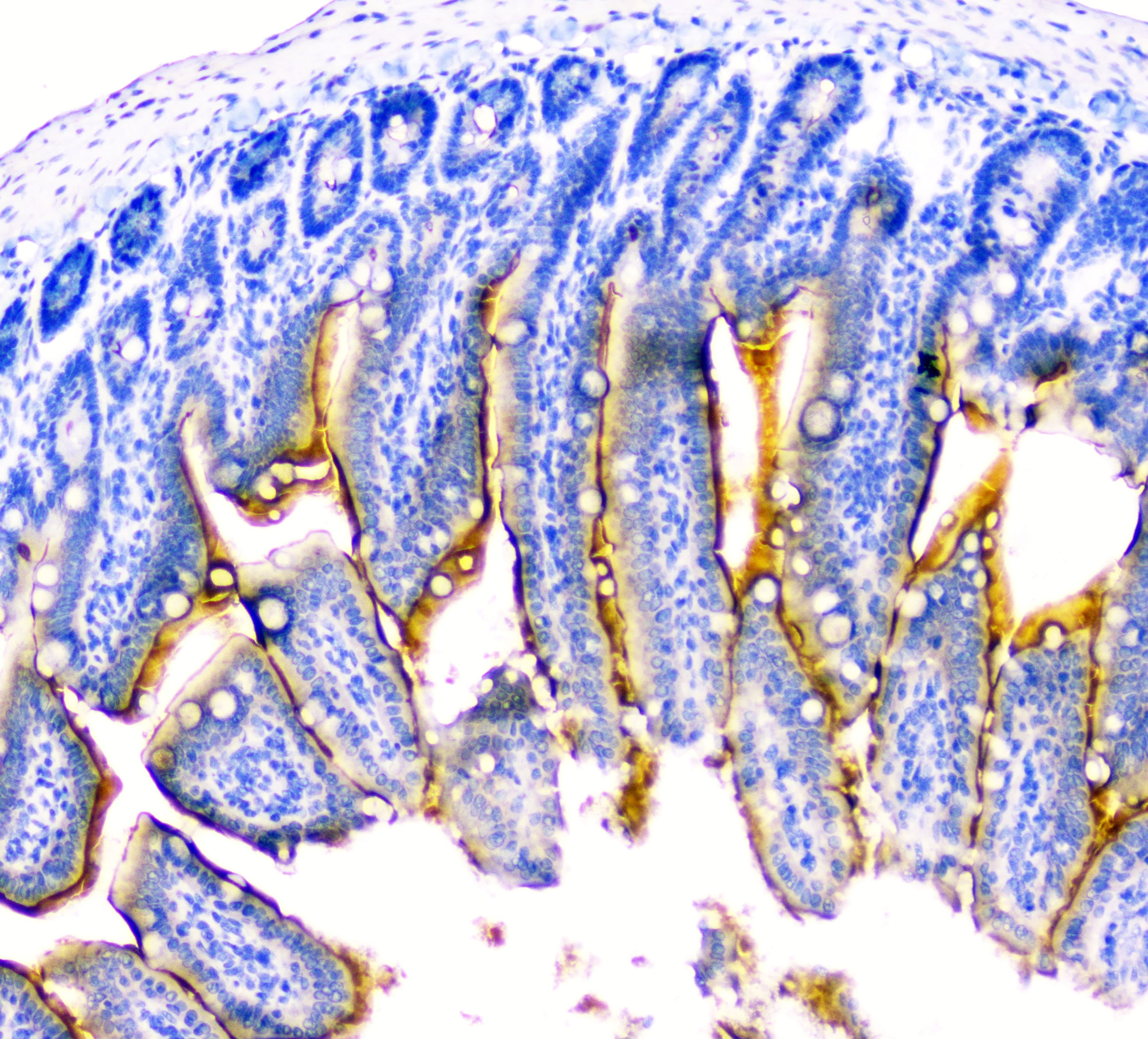 DDR2 Antibody