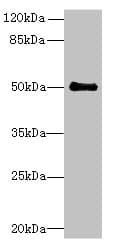 Polyclonal Rabbit anti-Human IFI44 Antibody (IHC, WB)