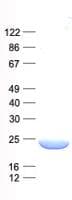 Human COMMD3 / BUP Protein (Recombinant His, N-Terminal)