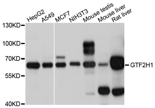 TFB1 / GTF2H1 Antibody