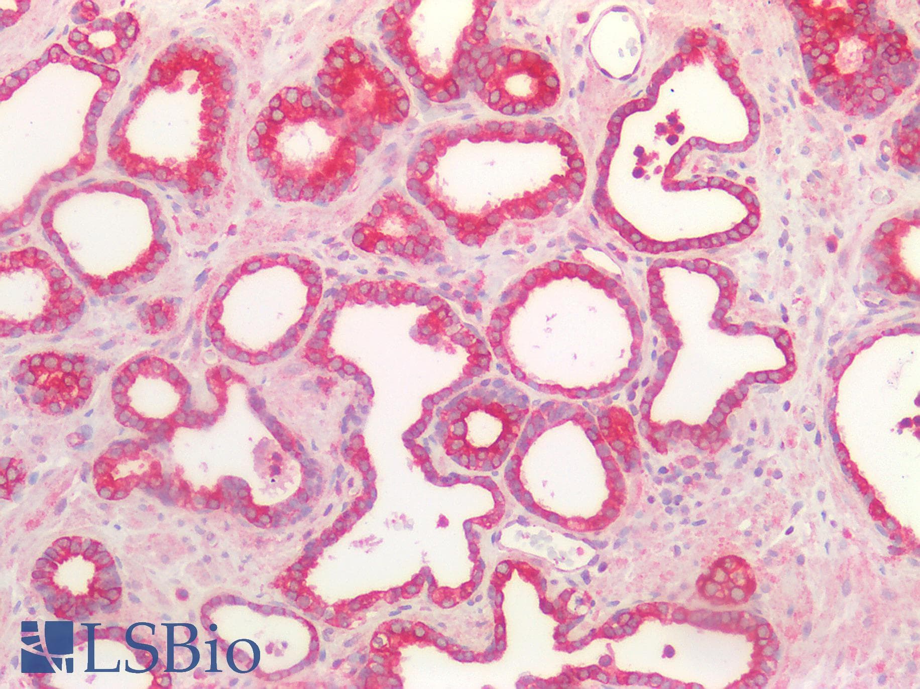IHC-plus™ TP53 / p53 Antibody