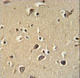 PCDHGC3 / PCDH2 Antibody (aa511-539)