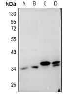CTSL / Cathepsin L Antibody