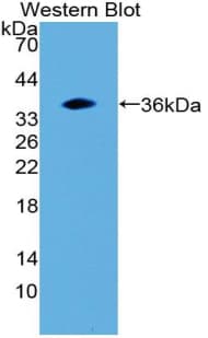 Prothrombin Fragment 1+2 Antibody (aa44-324)