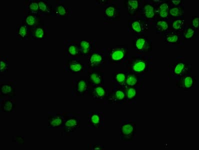 Polyclonal Rabbit anti-Human HIST1H3A Antibody (IHC, WB)