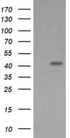 MAP2K1 / MKK1 / MEK1 Antibody (clone OTI2E8)