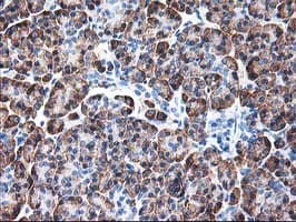 RPN1 / Ribophorin I Antibody (clone OTI6A9)