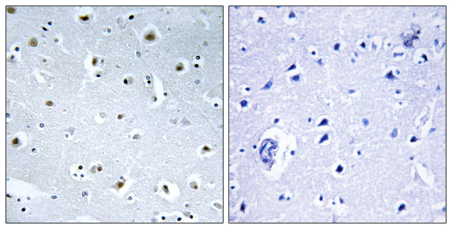 Polyclonal Rabbit anti-Human GCP3 / TUBGCP3 Antibody (aa201-250, IHC)