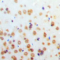 HIF1A / HIF1 Alpha Antibody (Internal)
