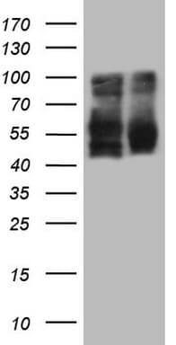 LRRTM1 Antibody (aa182-422, clone OTI5C3)
