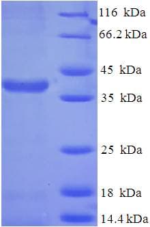 Human SCO2 Protein (Recombinant His-SUMO)
