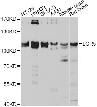 Polyclonal Rabbit anti-Human GPR49 / LGR5 Antibody (WB)