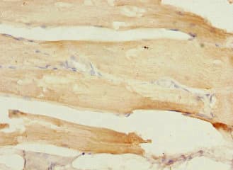 TCAP / Telethonin Antibody