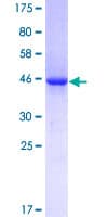 Human Vasohibin 1 / VASH1 Protein (Recombinant GST)