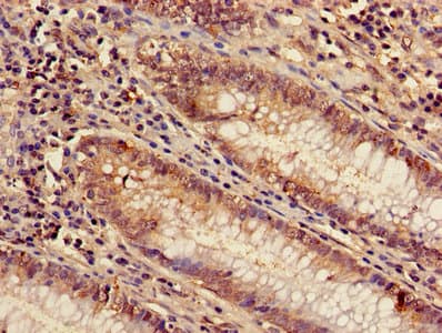 ARL4D Antibody