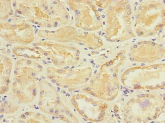 STRADA / LYK5 Antibody