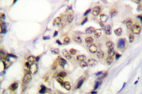 Polyclonal Rabbit anti-Human PR / Progesterone Receptor Antibody (Ala394, IHC, IF, WB)