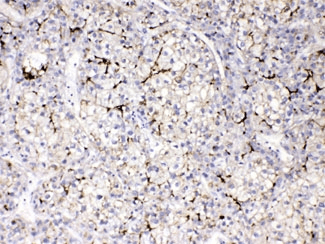 APOB / Apolipoprotein B Antibody