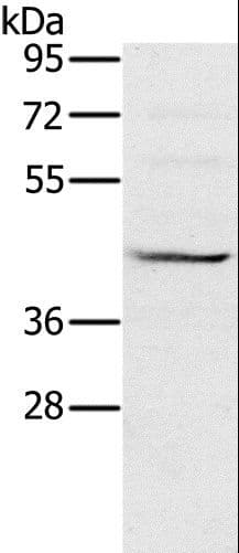 MVK Antibody