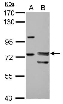 Polyclonal Rabbit anti-Human FOXP4 Antibody (WB)