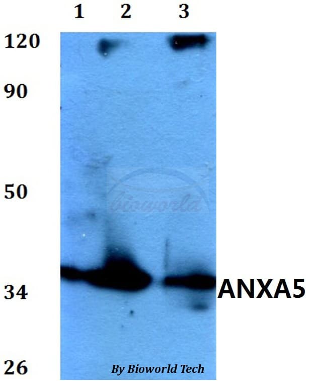 ANXA5 / Annexin V Antibody