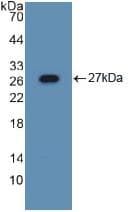 ASGR1 / ASGPR Antibody (aa80-281, APC)