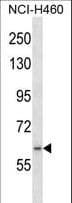 RNF19A / DORFIN Antibody (aa384-413)