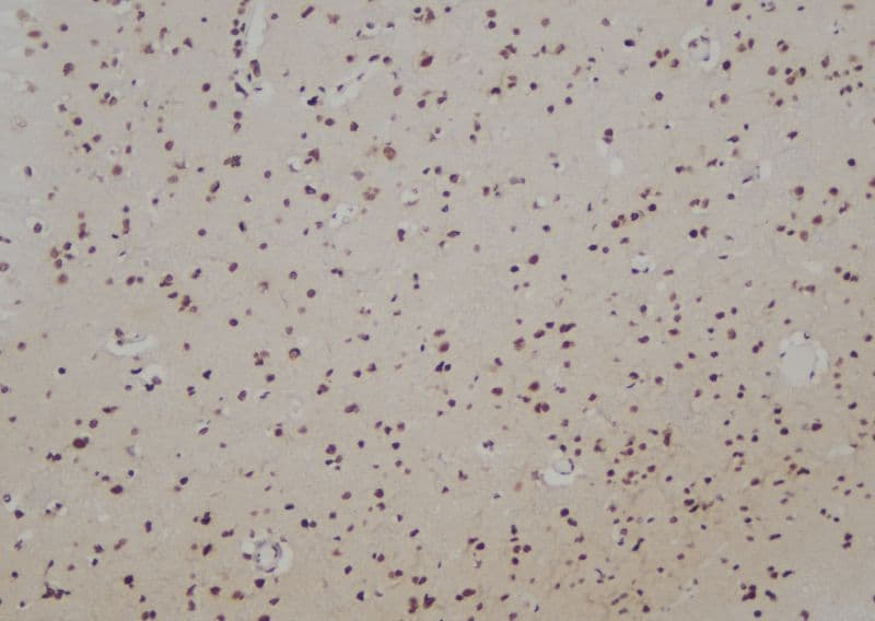 Polyclonal Rabbit anti-Human RAD51B Antibody (IHC, IF, WB)