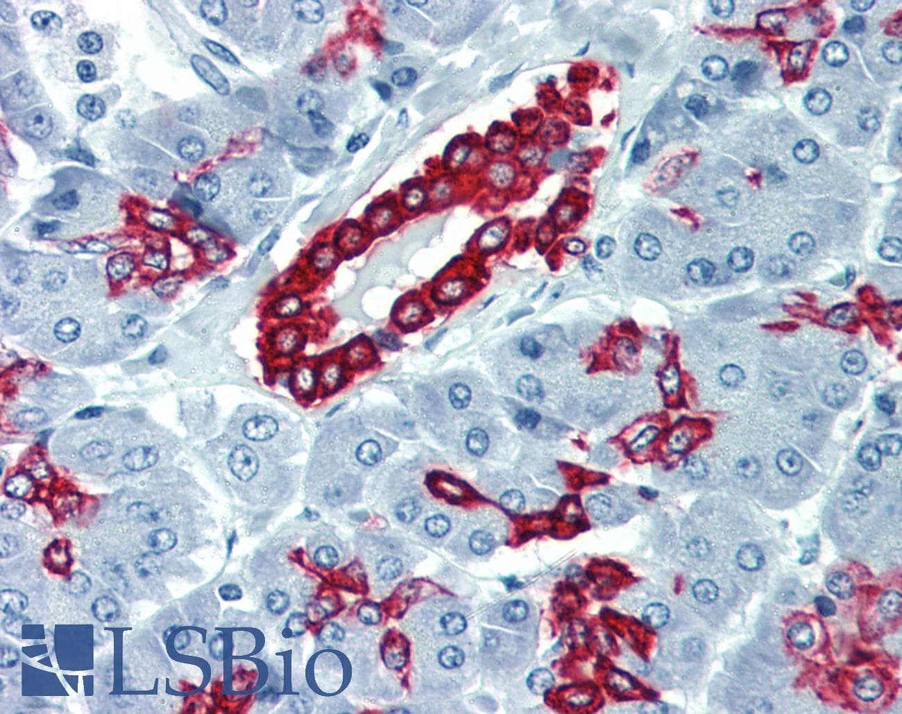PathPlus™ Polyclonal Rabbit anti-Human KRT19 / CK19 / Cytokeratin 19 Antibody (clone E16-L, C-Terminus, IHC)