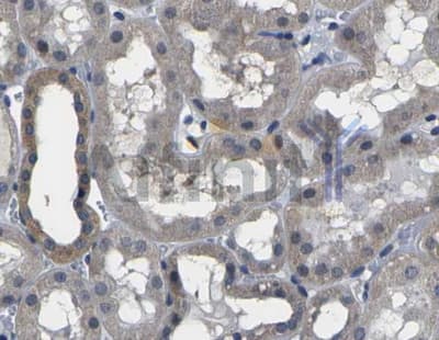 Polyclonal Rabbit anti-Human GSK3B / GSK3 Beta Antibody (IHC, IF, WB)