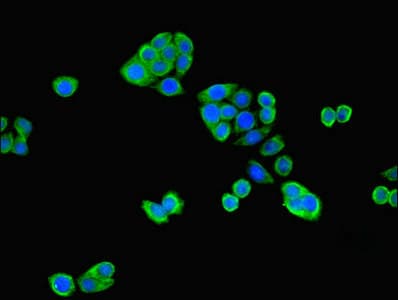 Polyclonal Rabbit anti-Human RNF31 Antibody (IHC)