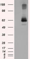 Monoclonal Mouse anti-Human LIPG / Endothelial Lipase Antibody (clone OTI6B11, IHC, IF, WB)