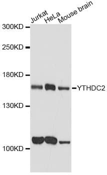 Polyclonal Rabbit anti-Human YTHDC2 Antibody (IF, WB)