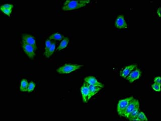 Polyclonal Rabbit anti-Human SLCO1C1 / OATPF Antibody (IHC, IF)