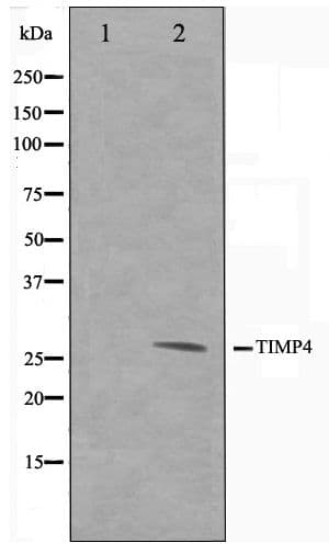 TIMP4 Antibody