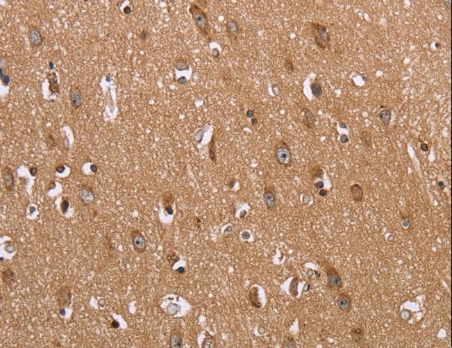 Polyclonal Rabbit anti-Human I-BABP / FABP6 Antibody (IHC)