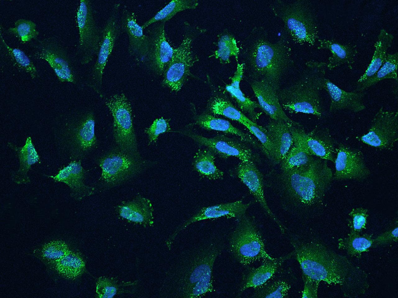 CALCOCO2 Antibody