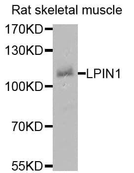 LPIN1 / Lipin 1 Antibody