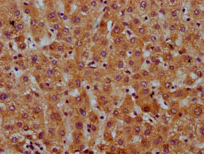 SAA2 / Serum Amyloid A2 Antibody