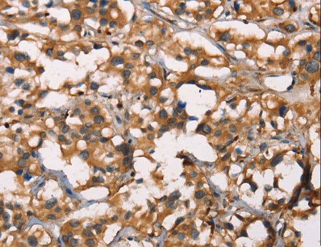 Polyclonal Rabbit anti-Human SENP1 Antibody (IHC, WB)