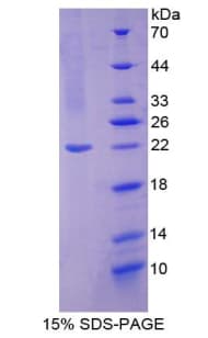 Human NOS2 / iNOS Protein (Recombinant His, N-Terminal)